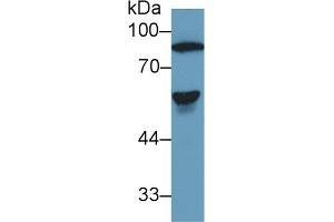 Detection of AT in Human Serum using Polyclonal Antibody to Antithrombin (AT) (SERPINC1 anticorps  (AA 150-426))
