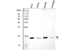 Western blot analysis of Prealbumin using anti-Prealbumin antibody (ABIN3042346). (TTR anticorps  (AA 21-147))