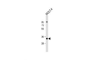 Western Blot at 1:1000 dilution + MOLT-4 whole cell lysate Lysates/proteins at 20 ug per lane. (ZWINT anticorps  (AA 59-88))