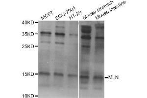 Western blot analysis of extracts of various cell lines, using MLN Antibody.