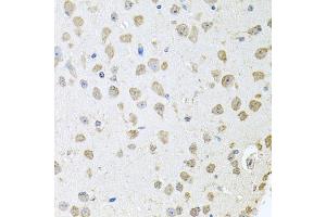 Immunohistochemistry of paraffin-embedded mouse brain using TARS antibody (ABIN5974207) at dilution of 1/100 (40x lens). (TARS anticorps)