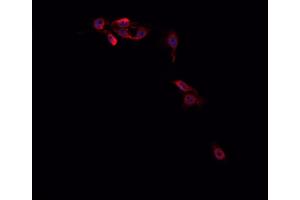 ABIN6266714 staining Hep G2 cells by IF/ICC. (MED14 anticorps  (Internal Region))