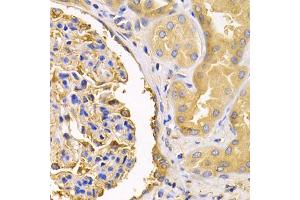 Immunohistochemistry of paraffin-embedded human kidney using USO1 antibody (ABIN1875291) at dilution of 1:200 (40x lens). (USO1 anticorps)