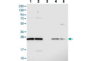 Western blot analysis of Lane 1: RT-4, Lane 2: U-251 MG, Lane 3: Human Plasma, Lane 4: Liver, Lane 5: Tonsil with C14orf166 polyclonal antibody  at 1:250-1:500 dilution. (C14orf166 anticorps)