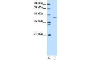 WB Suggested Anti-SEPHS1 Antibody Titration:  5.
