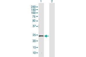 Western Blot analysis of CBR4 expression in transfected 293T cell line by CBR4 MaxPab polyclonal antibody.