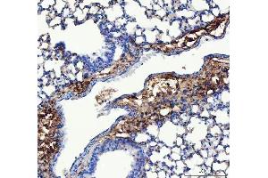 IHC analysis of Collagen III/COL3A1 using anti-Collagen III/COL3A1 antibody (ABIN6719295).