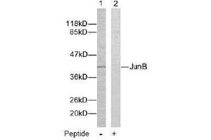 Image no. 2 for anti-Jun B Proto-Oncogene (JUNB) (Ser259) antibody (ABIN197141) (JunB anticorps  (Ser259))