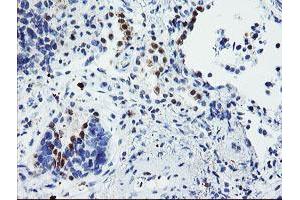 Image no. 7 for anti-Ubiquitin Specific Peptidase 36 (USP36) (AA 589-972) antibody (ABIN1491604)