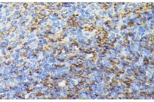 Immunohistochemistry of paraffin-embedded Mouse spleen using COX15 Polyclonal Antibody at dilution of 1:100 (40x lens). (COX15 anticorps)