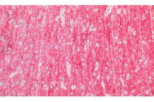 Detection of ICAM5 in Human Cortex Tissue using Polyclonal Antibody to Intercellular Adhesion Molecule 5 (ICAM5)