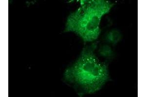 Anti-QPRT mouse monoclonal antibody (ABIN2453564) immunofluorescent staining of COS7 cells transiently transfected by pCMV6-ENTRY QPRT (RC202960). (QPRT anticorps)