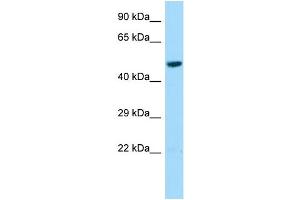 Host: Rabbit Target Name: L2HGDH Sample Type: HepG2 Whole Cell lysates Antibody Dilution: 1. (L2HGDH anticorps  (Middle Region))