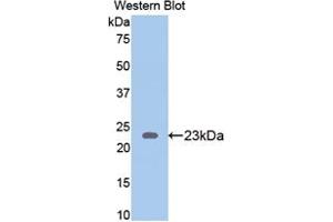 Western blot analysis of the recombinant protein. (Thrombospondin 1 anticorps  (AA 71-259))