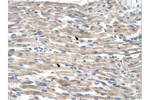 Immunohistochemistry (IHC) image for anti-BMP2 Inducible Kinase (BMP2K) (C-Term) antibody (ABIN2775440)