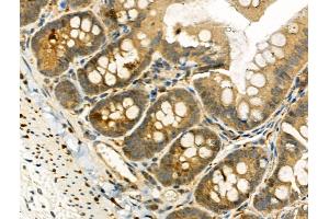 Phospho-TAO2 (Ser181) Antibody at 1/100 staining Rat colorectal tissue by IHC-P. (TAO Kinase 2 anticorps  (pSer181))