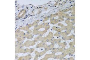 Immunohistochemistry of paraffin-embedded human liver injury using ATAD3B antibody. (ATAD3B anticorps)