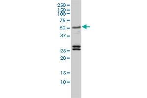 TFEB monoclonal antibody (M01), clone 3E1-G6 Western Blot analysis of TFEB expression in Jurkat (TFEB anticorps  (AA 1-476))