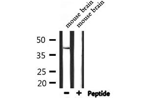 Western blot analysis of extracts from mouse brain, using STAC3 Antibody.
