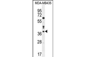 CASP3 Antibody (C-term) (ABIN655271 and ABIN2844863) western blot analysis in MDA-M cell line lysates (35 μg/lane). (Caspase 3 anticorps  (C-Term))
