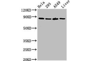 Western Blot Positive WB detected in: Hela whole cell lysate, 293 whole cell lysate, A549 whole cell lysate, Rat liver tissue All lanes: USP10 antibody at 3 μg/mL Secondary Goat polyclonal to rabbit IgG at 1/50000 dilution Predicted band size: 88, 93 kDa Observed band size: 88 kDa (USP1 anticorps  (AA 453-592))