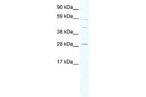 WB Suggested Anti-SPI1 Antibody Titration: 0. (SPI1 anticorps  (Middle Region))