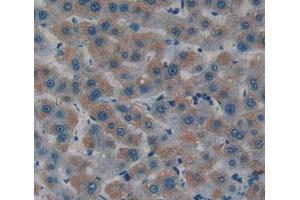 Used in DAB staining on fromalin fixed paraffin- embedded Kidney tissue