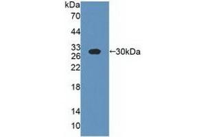 Detection of Recombinant CSN1, Bovine using Polyclonal Antibody to Casein Alpha (CSN1) (Casein alpha S1 anticorps  (AA 16-187))