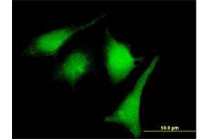 Immunofluorescence of purified MaxPab rabbit antibody to MAP2K2 on HeLa cell. (MEK2 anticorps  (AA 1-400))