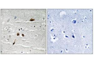 Immunohistochemistry analysis of paraffin-embedded human brain tissue using MDC1 (Phospho-Ser513) antibody. (MDC1 anticorps  (pSer513))