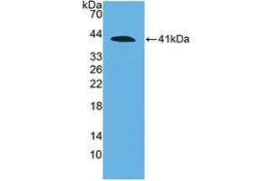 Western blot analysis of recombinant Human C4a. (C4A anticorps  (AA 680-756))