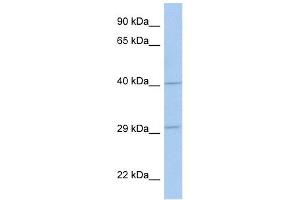ART5 antibody used at 1 ug/ml to detect target protein. (ART5 anticorps  (Middle Region))