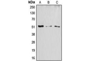 Western blot analysis of ATF2 expression in HeLa (A), SP2/0 (B), H9C2 (C) whole cell lysates.
