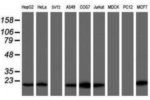 Image no. 7 for anti-Copper Metabolism (Murr1) Domain Containing 1 (COMMD1) antibody (ABIN1497563)