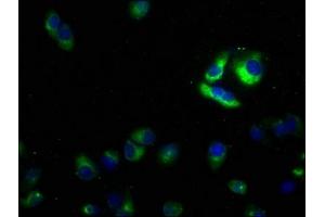 Immunofluorescence staining of Hela cells with ABIN7176698 at 1:50, counter-stained with DAPI.