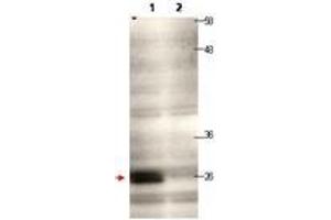 Image no. 1 for anti-Centromere Protein Q (CENPQ) antibody (ABIN1100754) (CENPQ anticorps)