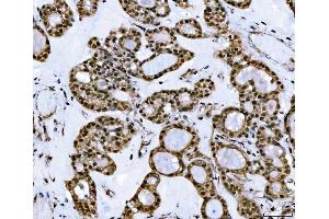 IHC analysis of TIP49A/RUVBL1 using anti-TIP49A/RUVBL1 antibody (ABIN7599928). (RUVBL1 anticorps  (AA 13-23))