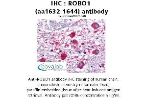 Image no. 1 for anti-Roundabout, Axon Guidance Receptor, Homolog 1 (ROBO1) (AA 1632-1644) antibody (ABIN1738905) (ROBO1 anticorps  (AA 1632-1644))