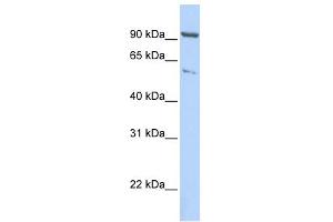 WB Suggested Anti-KIF2A Antibody Titration:  0. (KIF2A anticorps  (C-Term))