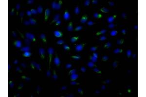 anti-rho-Associated, Coiled-Coil Containing Protein Kinase 2 (ROCK2) antibody