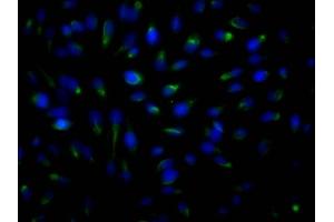 Immunofluorescence staining of Hela Cells with ABIN7127797 at 1:50, counter-stained with DAPI. (Recombinant ROCK2 anticorps)