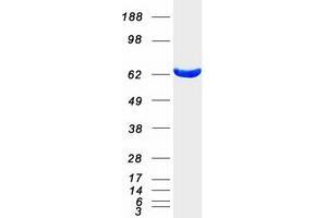 Validation with Western Blot