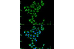 Immunofluorescence analysis of A549 cells using COQ3 antibody (ABIN4903350). (COQ3 anticorps)