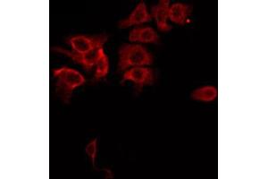ABIN6267685 staining MDA-MB-435 by IF/ICC. (ASK1 anticorps  (pSer83))