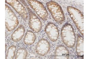 Immunoperoxidase of purified MaxPab rabbit antibody to GOT1 on formalin-fixed paraffin-embedded human colon.