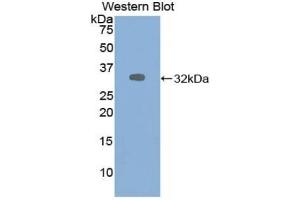 Detection of Recombinant ALDOA, Human using Polyclonal Antibody to Aldolase A, Fructose Bisphosphate (ALDOA)