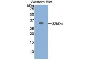 Detection of Recombinant ALDOA, Human using Polyclonal Antibody to Aldolase A, Fructose Bisphosphate (ALDOA) (ALDOA anticorps  (AA 18-273))
