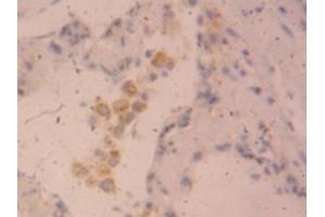 Detection of CLCF1 in Human Lung Tissue using Polyclonal Antibody to Cardiotrophin Like Cytokine Factor 1 (CLCF1)