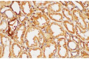 Immunohistochemistry of paraffin-embedded Human kidney using FGB Polycloanl Antibody at dilution of 1:200