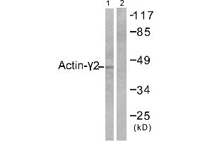 Western blot analysis of extracts from COLO205 cells, using Actin-γ2 antibody. (ACTG2 anticorps)